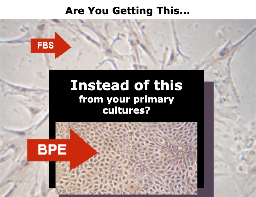 Are you getting FBS instead of BPE from your primary cultures?