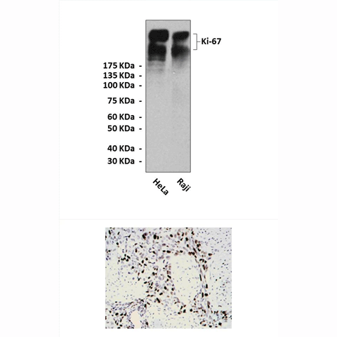 Anti Ki 67 Mouse Antibody